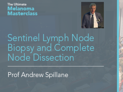 Sentinel Lymph Node Biopsy and Complete Node Dissection | 10 min