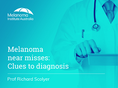 Melanoma near misses: Clues to diagnosis | 51 min
